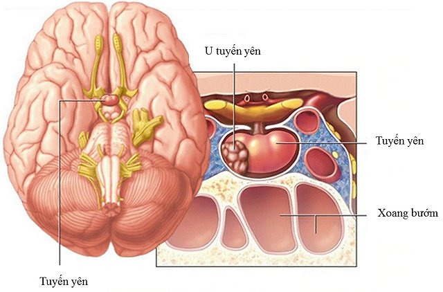 Phòng ngừa ung thư tuyến giáp hiệu quả